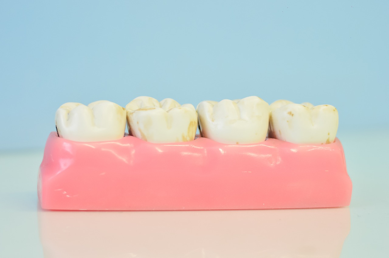 dental sample