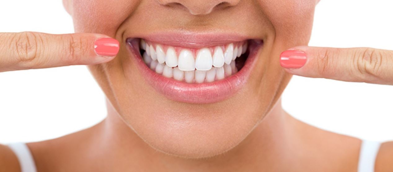 white teeth